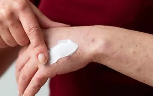 How to Cope Better With Eczema